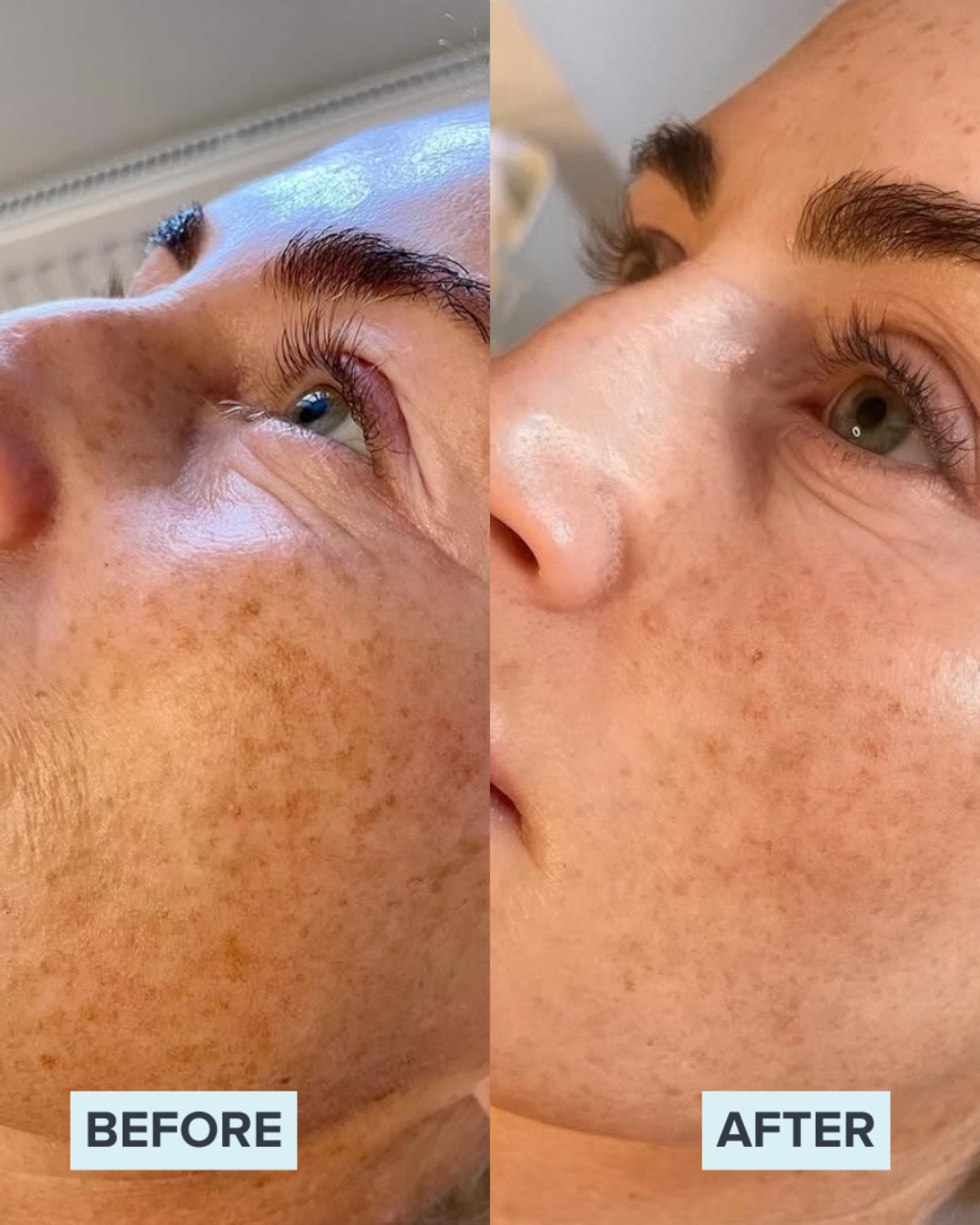 For the best skin care treatments in Atlanta, GA, turn to Skintherapy.