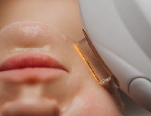 Reversing Signs of Aging with Photofacials