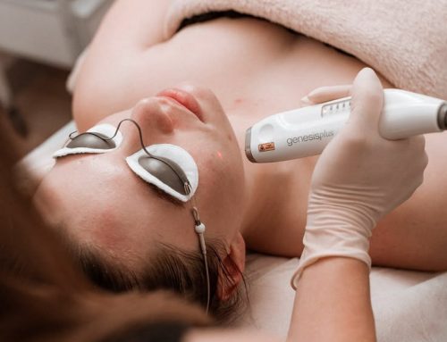 Not Just One and Done: All About Laser Genesis